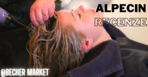 a woman receiving a hair treatment with a hand applying product, showcasing Alpecin hair care for potential review on its effects against hair loss.