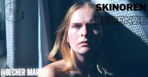 a close-up portrait of a person with apparent acne on the face, used in a review context for Skinoren recenze.