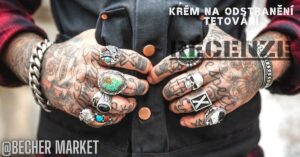 Zkušenosti S Krémem Pro Odstranění Tetování Bez Jizev - Recenze