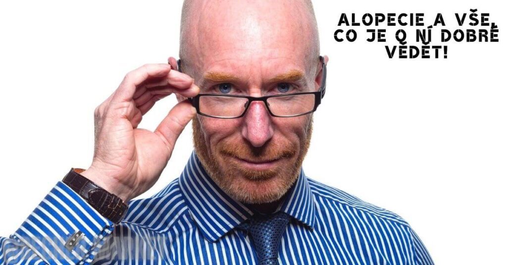 Alopecie A Vše, Co Je O Ní Dobré Vědět!