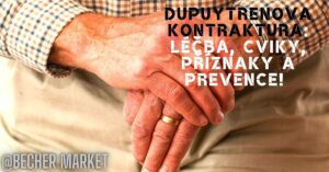 an elderly person holding their hand showing signs of Dupuytren’s contracture with text overlay in Slovak about treatment, exercises, symptoms, and prevention.