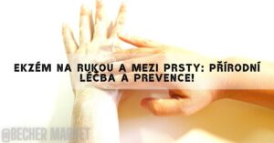 Ekzém Na Rukou A Mezi Prsty: Přírodní Léčba A Prevence!