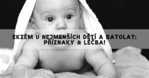 a baby wrapped in a towel showing signs of skin irritation, possibly related to ekzém u kojenců, with a focused expression.