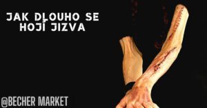 Jak Dlouho Se Hojí Jizva? Jak Urychlit Proces Hojení!