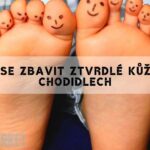 Jak Se Zbavit Ztvrdlé Kůže Na Nohou A Dosáhnout Měkkých A Krásných