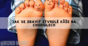 Jak Se Zbavit Ztvrdlé Kůže Na Nohou A Dosáhnout Měkkých A Krásných