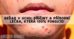 Beďar V Uchu: Příčiny & Přírodní Léčba, Která 100% Funguje!
