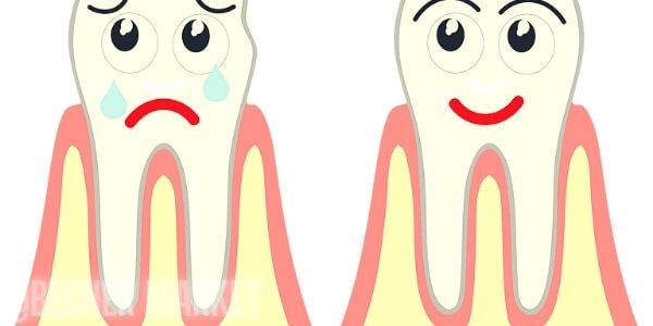 jak se zbavit vacku u zubu