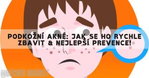 a stylized illustration of a face with highlighted under-the-skin blemishes, emphasizing podkožní akné treatment and prevention tips.