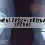 Poranění Čéšky: Příznaky & Léčba!