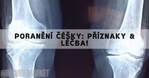 Poranění Čéšky: Příznaky & Léčba!