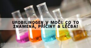 four laboratory test tubes containing colored liquids, likely representing different urine samples for medical diagnostics