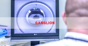 a medical MRI scan showing a cross-section of a wrist with the term "ganglion" highlighted, indicating a cystic tumor near a joint.