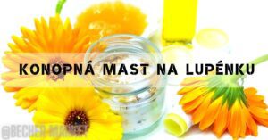 Jak Konopná mast pomáhá na Lupénku