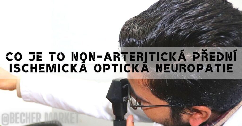 Co je to non-arteritická přední ischemická optická neuropatie