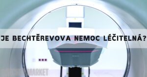 Je Bechtěrevova Nemoc smrtelná? Dá se léčit?