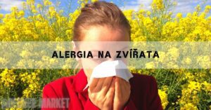 a person sneezing into a tissue amidst a field of bright yellow flowers, showing symptoms of animal allergy.