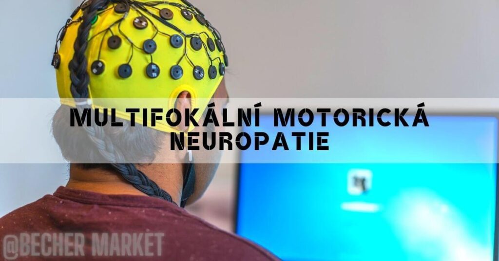 Multifokální motorická neuropatie: Vše co potřebujete vědět!