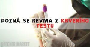 a gloved hand holding a blood sample tube for diagnostic testing related to rheumatic disease analysis