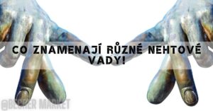 Co znamenají hrbolate nehty pro vaše zdraví [vlnky & vroubky na nehtech]!