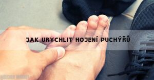 Jak Se Co Nejrychleji Zbavit Puchýře + Nejlepší Babské Rady!