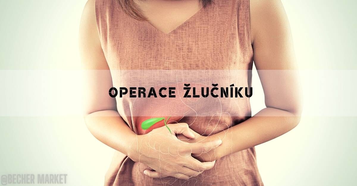 Operace Žlučníku: Délka operace, Rekonvalescence & Dieta!
