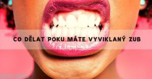 Vyviklaný Zub: Co dělat u dětí i dospělých!