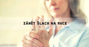 Jak Poznat Zánět Šlach Na Ruce? Příznaky, Léčba i Alternativní!