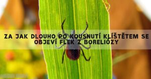 Borelióza Skvrna: Jak Dlouho Po Kousnutí Klíštětem? Kdy Zmizí?