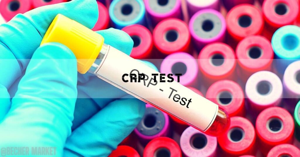 CRP Test [Hodnoty & Vše Co Potřebujete Vědět]