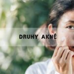 Druhy Akné: Jak Vzniká & Nejlepší Způsoby Prevence & Léčby!
