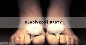 a pair of feet holding two large mushrooms, illustrating the deformity of kladívkové prsty on toes