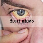 Žluté Bělmo: Játra, Žloutenka a Další Příčiny & Léčba!