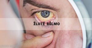 Žluté Bělmo: Játra, Žloutenka a Další Příčiny & Léčba!