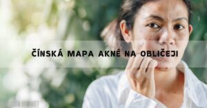Čínská Mapa Akné Na Obličeji: Příčiny, Léčba i Alternativní!