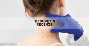 Redupetin Krém [Recenze & Zkušenosti] Je Předražený?