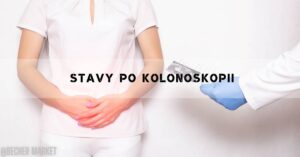 Stavy Po Kolonoskopii [Co Je Normální & Kdy Volat Lékaře]