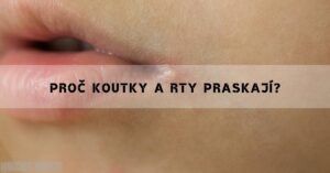 Co Pomáhá Na Popraskané Koutky? Příčiny, Léčba & Babské Rady!