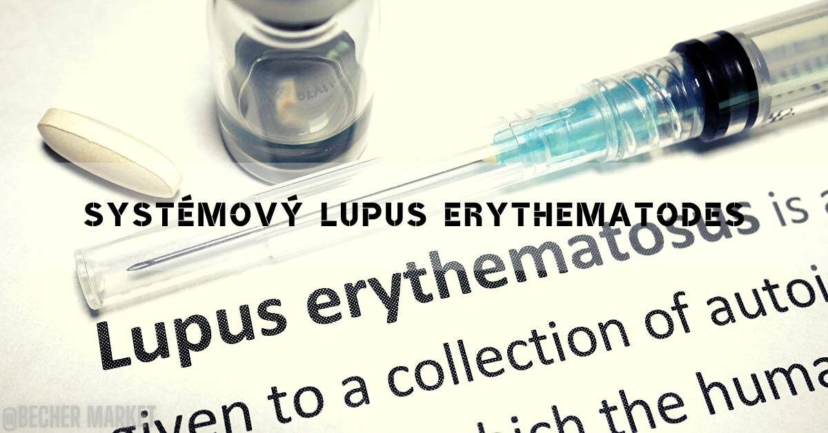 Systémový Lupus Erythematode: Příznaky, Diagnóza & Léčba!