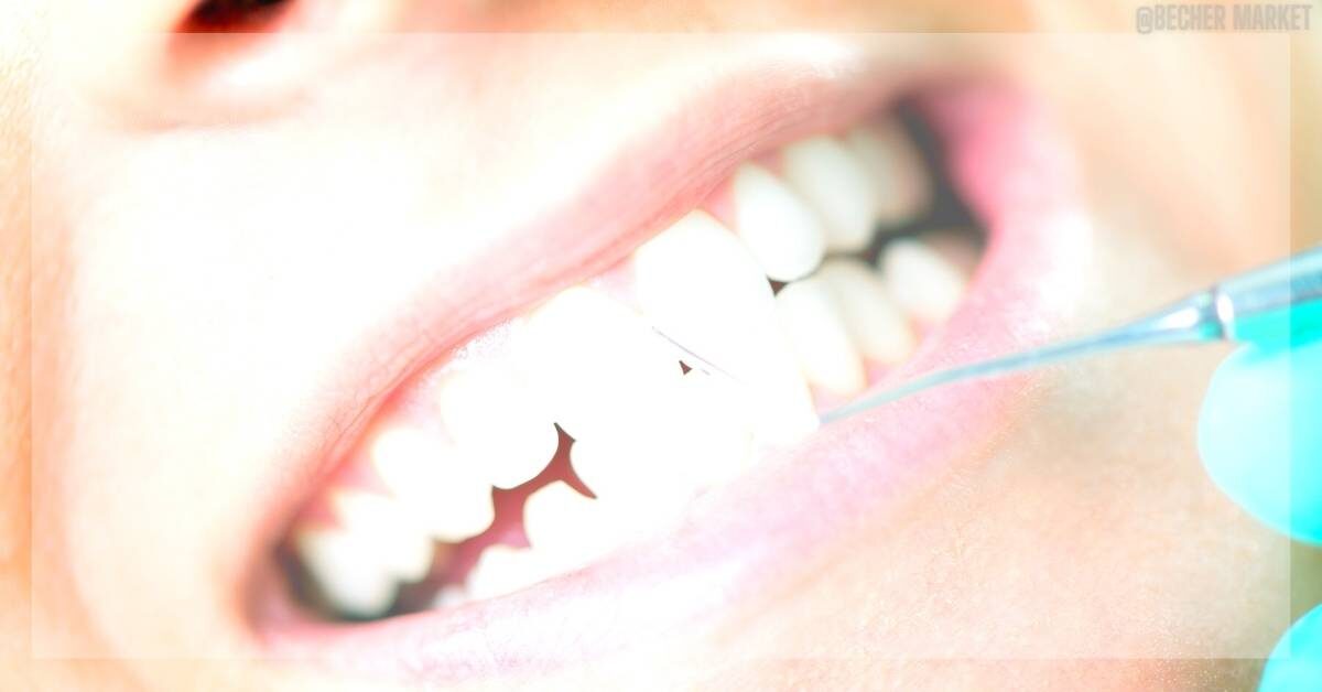 3 Způsoby Jak Odstranit Zubní Kámen Přírodní Cestou!