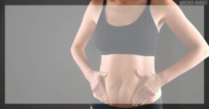 Abdominoplastika: Cena, Vše O Zákroku & Rekonvalescence!