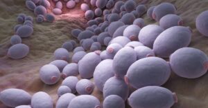 Kandidóza [Candida Albicans]: Příznaky, Léčba & Doporučená Dieta