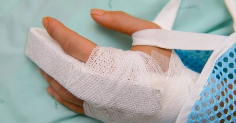 Jak poznat zlomený prst: Příznaky a způsoby léčby » Becher Market