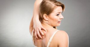 Proč mě svědí záda: Možné příčiny a řešení