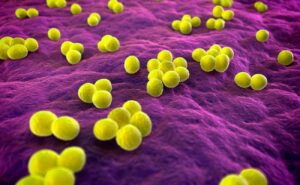 MRSA (Zlatý Stafylokok): Příznaky, Léčba & Alternativní Léčba!