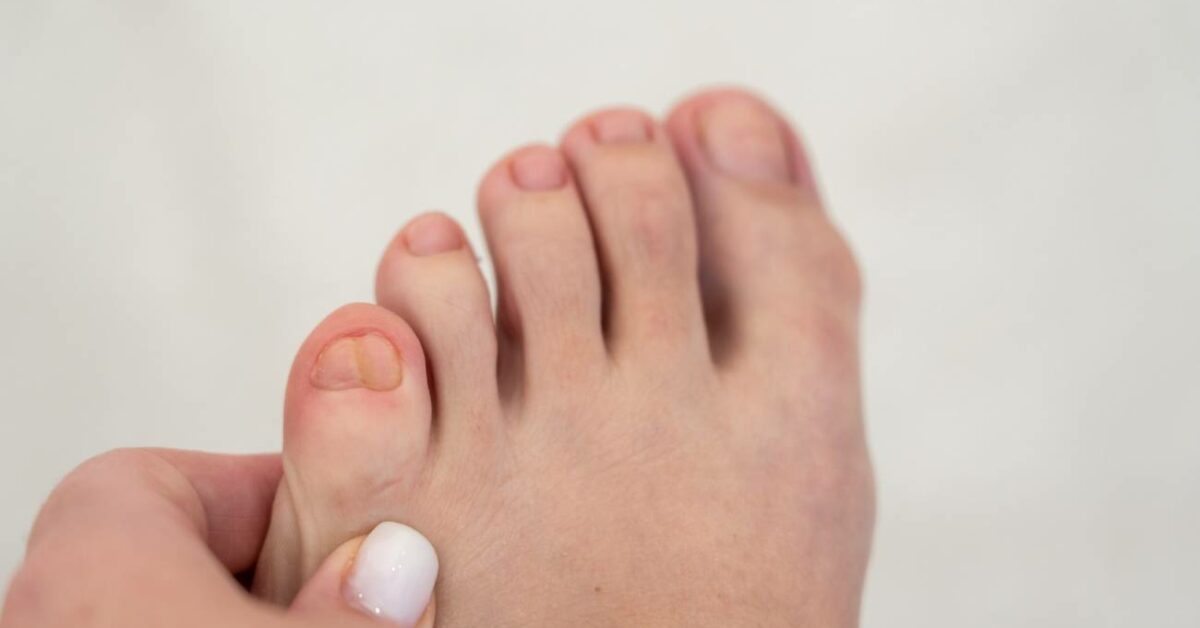 Jak rozeznat naražený prst od zlomeného na noze: Praktický průvodce pro rozpoznání a léčbu poranění prstu